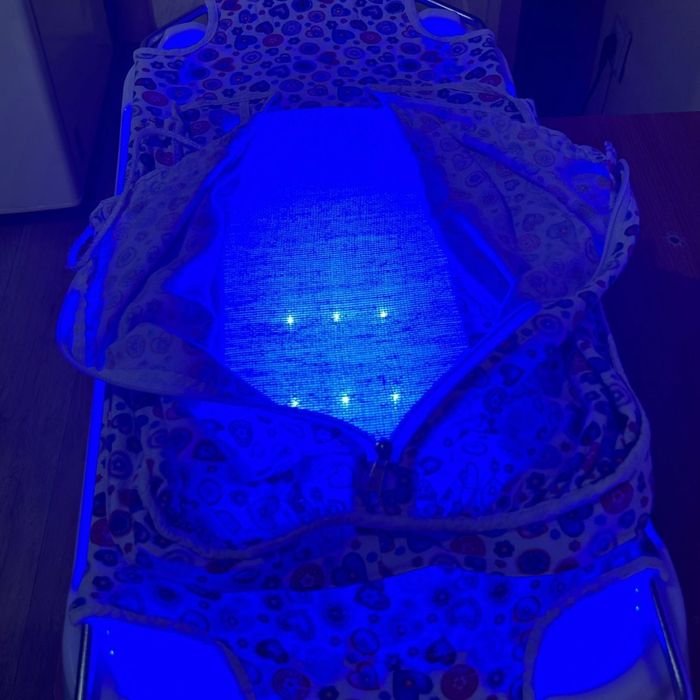 Билитест билирубин