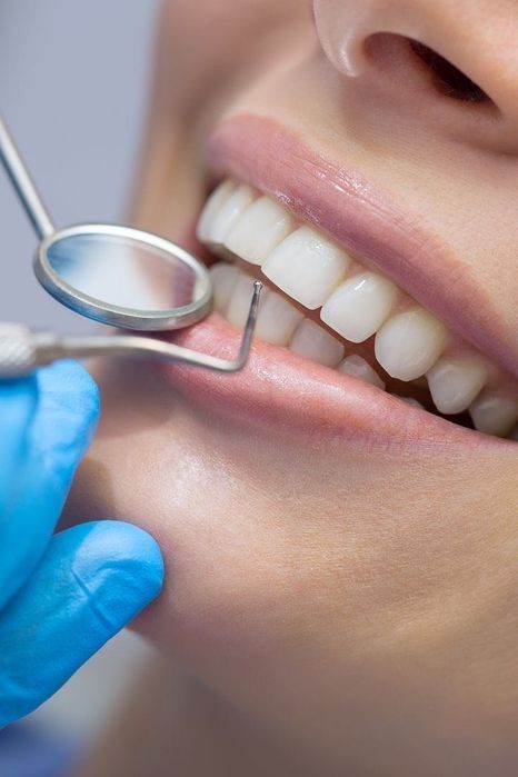 Стоматологично лечение