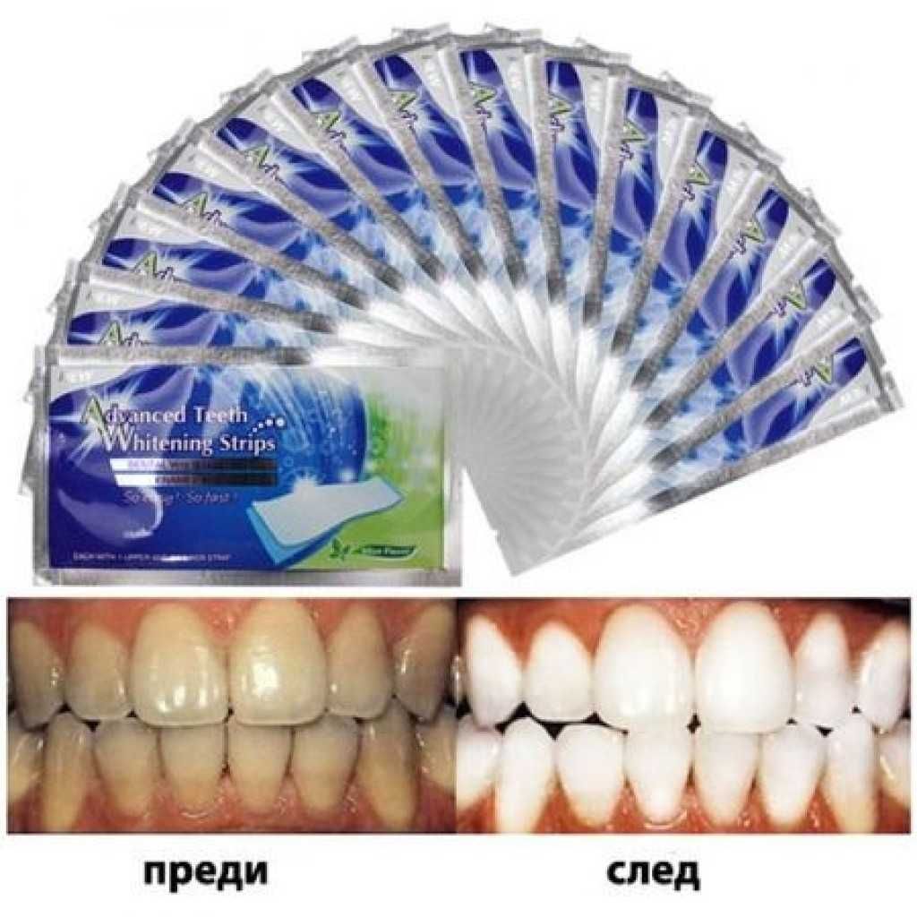 Избелващи ленти за зъби Advanced Teeth Whitening Strips