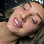 Acid hialuronic