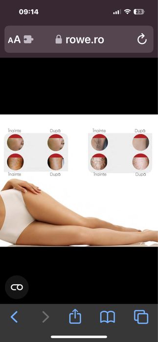 Altesse Nanolaser Trilogy