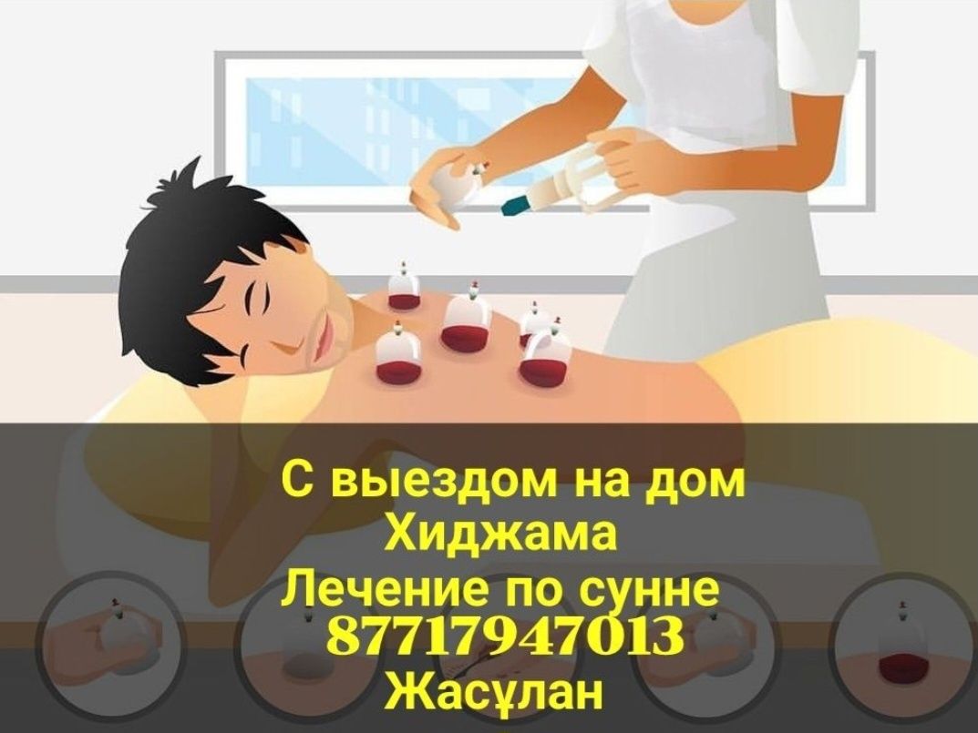 Хиджама выездом на дом.