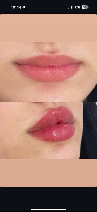 Косметолог Kosmetolog Kasmetologik muolajalar