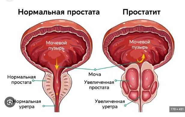 Молодой парень массажист. Урологический массаж. Лечение простаты.