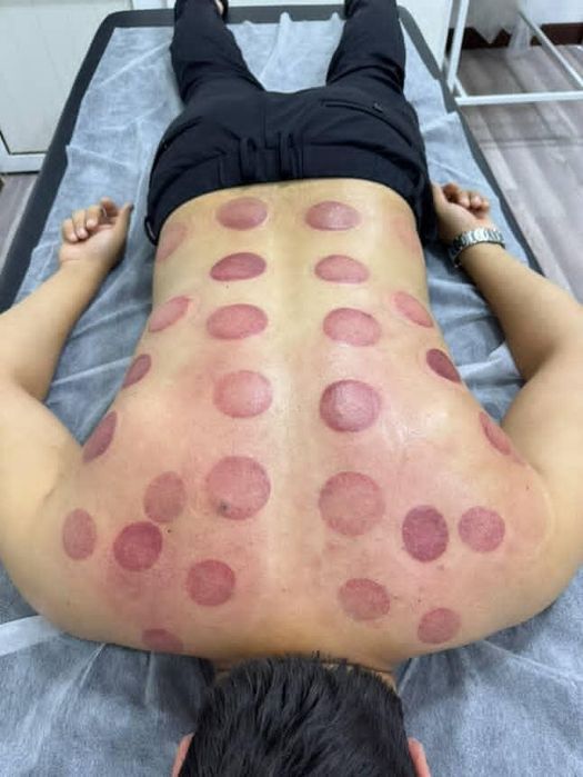 Hijoma xijoma muolajasi hijoma xizmati