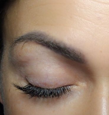 Aplic extensii de gene