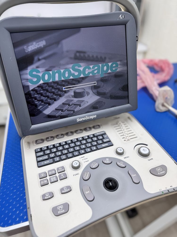 Vand ecograf SonoScape A5