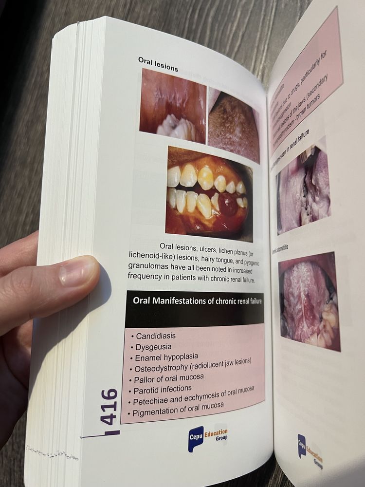 Учебник по орална патология / textbook in oral pathology