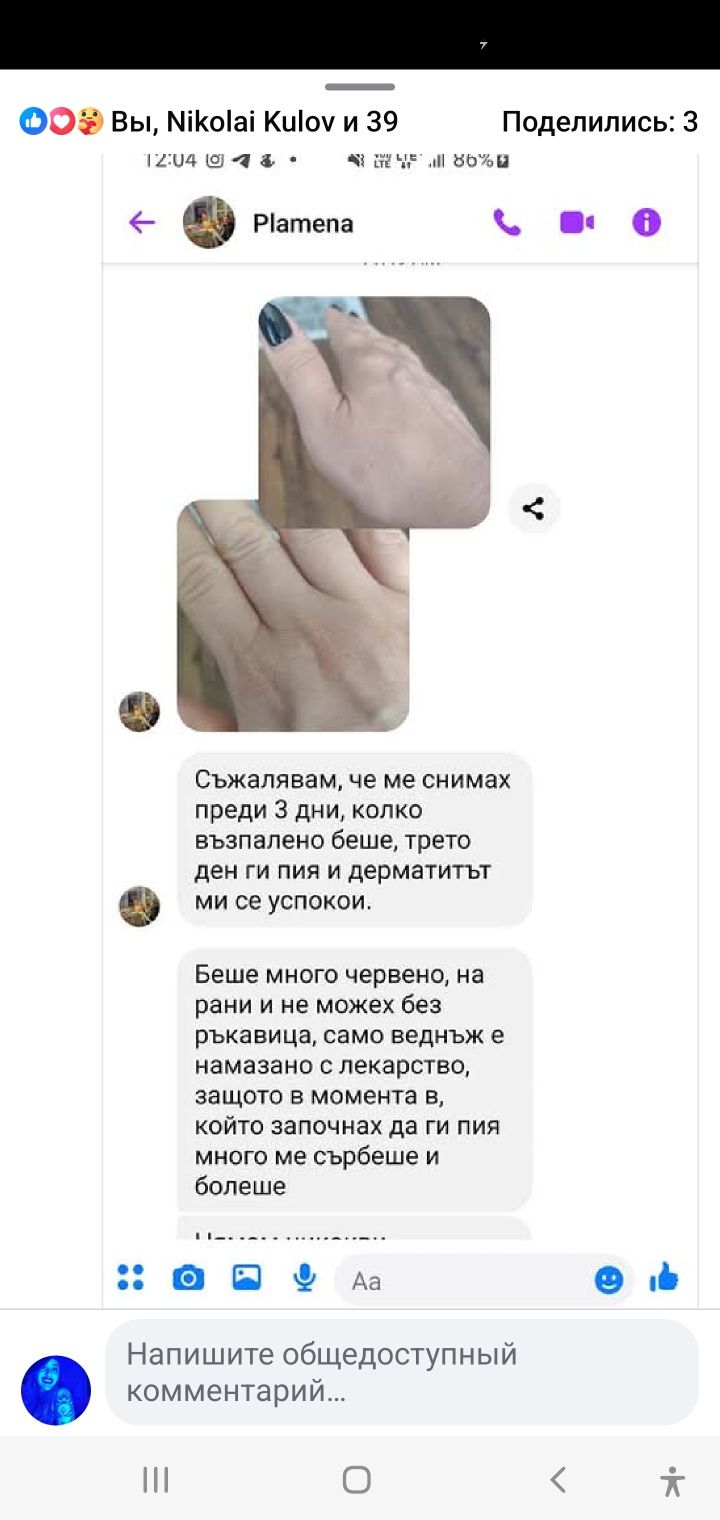 Антипаразитарен/АНТИГЪБИЧЕН комплекс