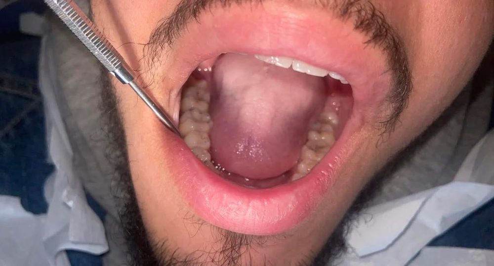 безплатно стоматологично лечение за пациенти със спонтанна болка