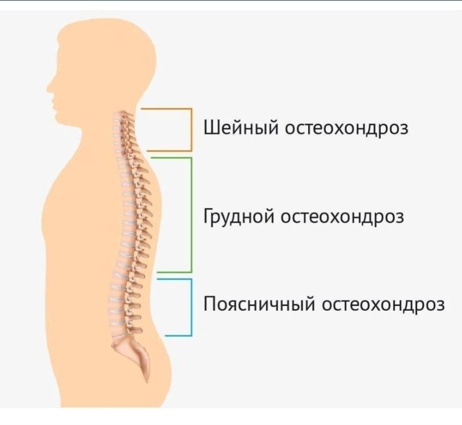 Массаж седальчный нервка.Арка омырткага