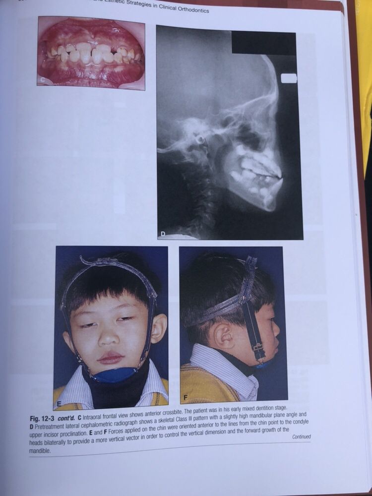 Biomechanics and Esthetics Strategies in Clinical Orthodontics NANDA