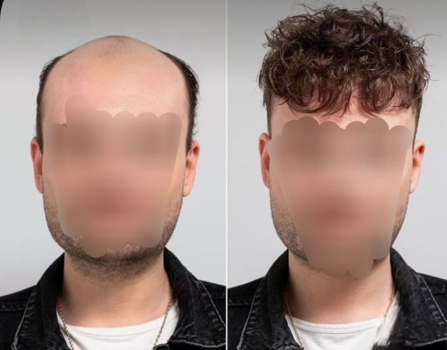 Мъжки системи от естествена коса Промоция от 650лв