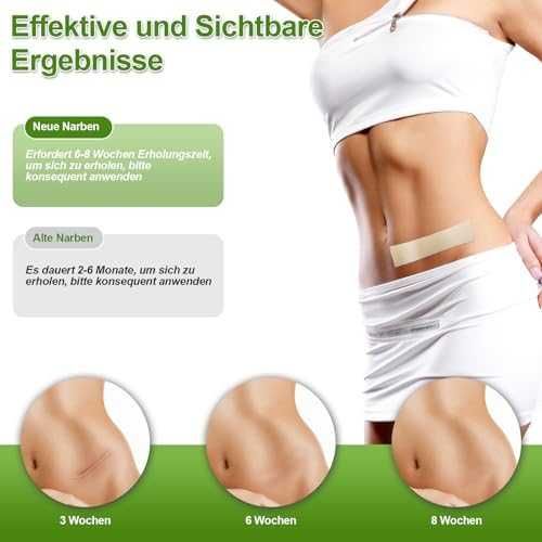 Нов Силиконов комплект за белези – лента и лепенки 4x15см, 4x150см