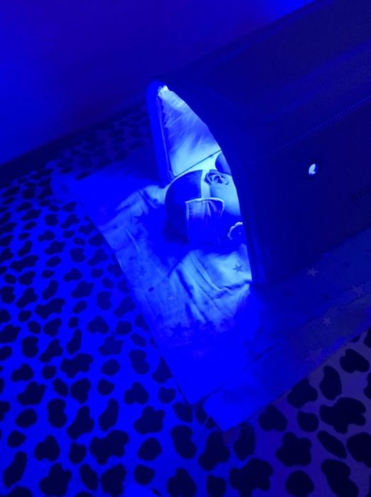 ЛАМПА  для желтухи. Для новорождённого детей.