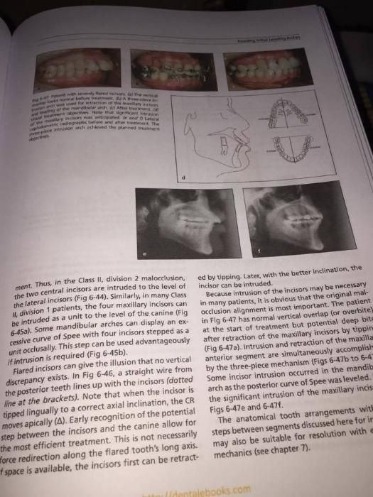 The Biomechanical Foundation of Clinical Orthodontics 2015