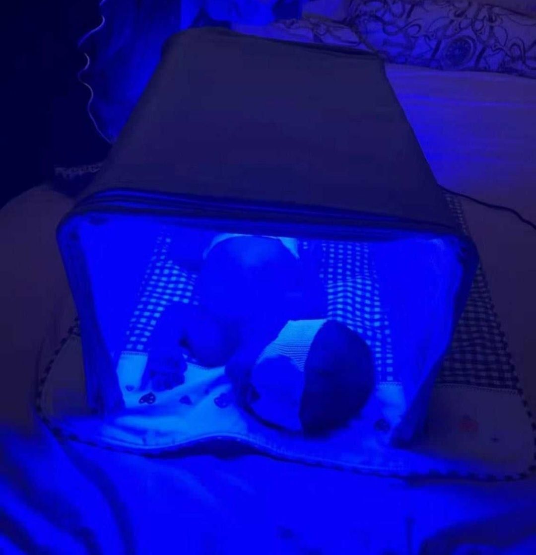 Фотолампа от желтушки у новорожденных