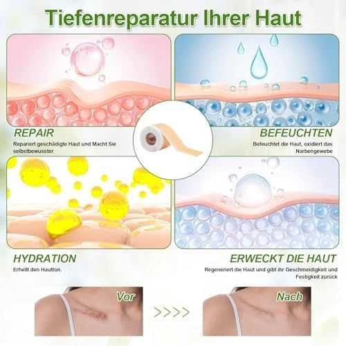 Нов Силиконов комплект за белези – лента и лепенки 4x15см, 4x150см