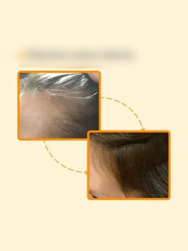 Средство для роста волос