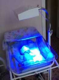 Fotolampa - chaqaloq sariqligiga ishonchli yechim