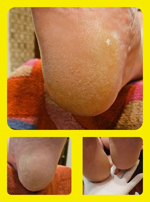 Pedichiură clasică Oradea