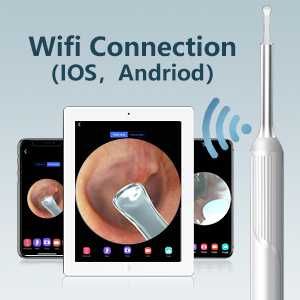 Смарт WiFi отоскоп Sheealthub