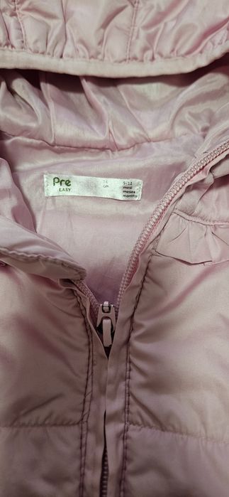 2 geci fetita Prenatal