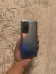 Redmi 10 sensr siniq qogan joyi tnq
