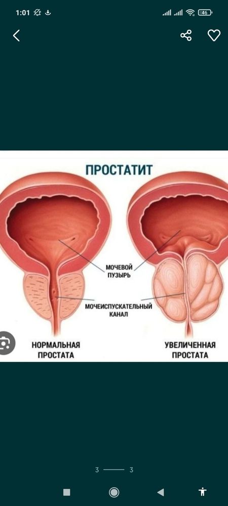 Массаж всего тело + урологическии 20.000 тысяч