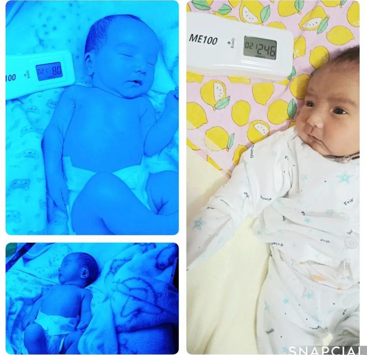 Bolada sariqlikni pasaytirivchi fototerapiya lampasi ijarasi.