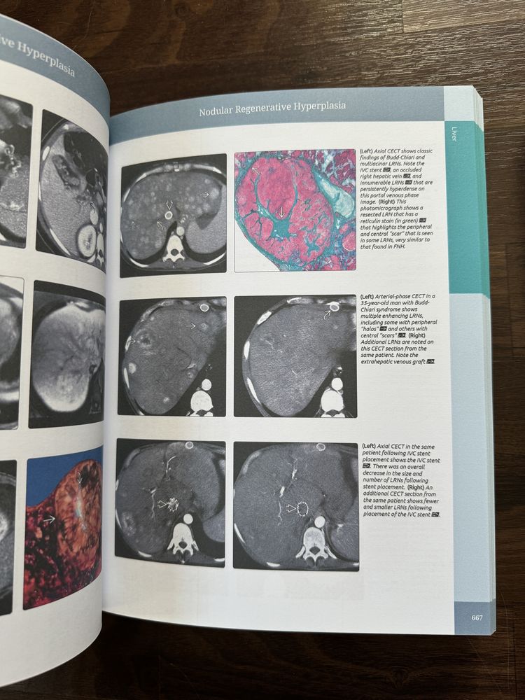 Diagnostic Imaging Gastrointestinal 2015