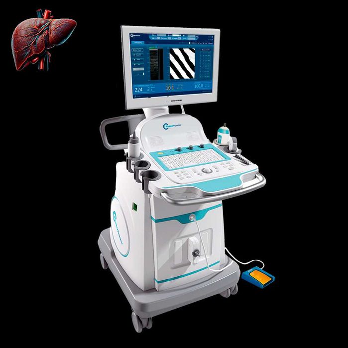 Стоматологический Томограф, Стом Рентген, Фиброскан