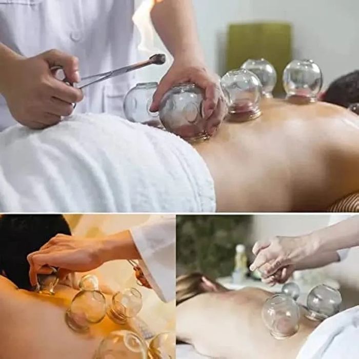 Вакуумные медицинские банки