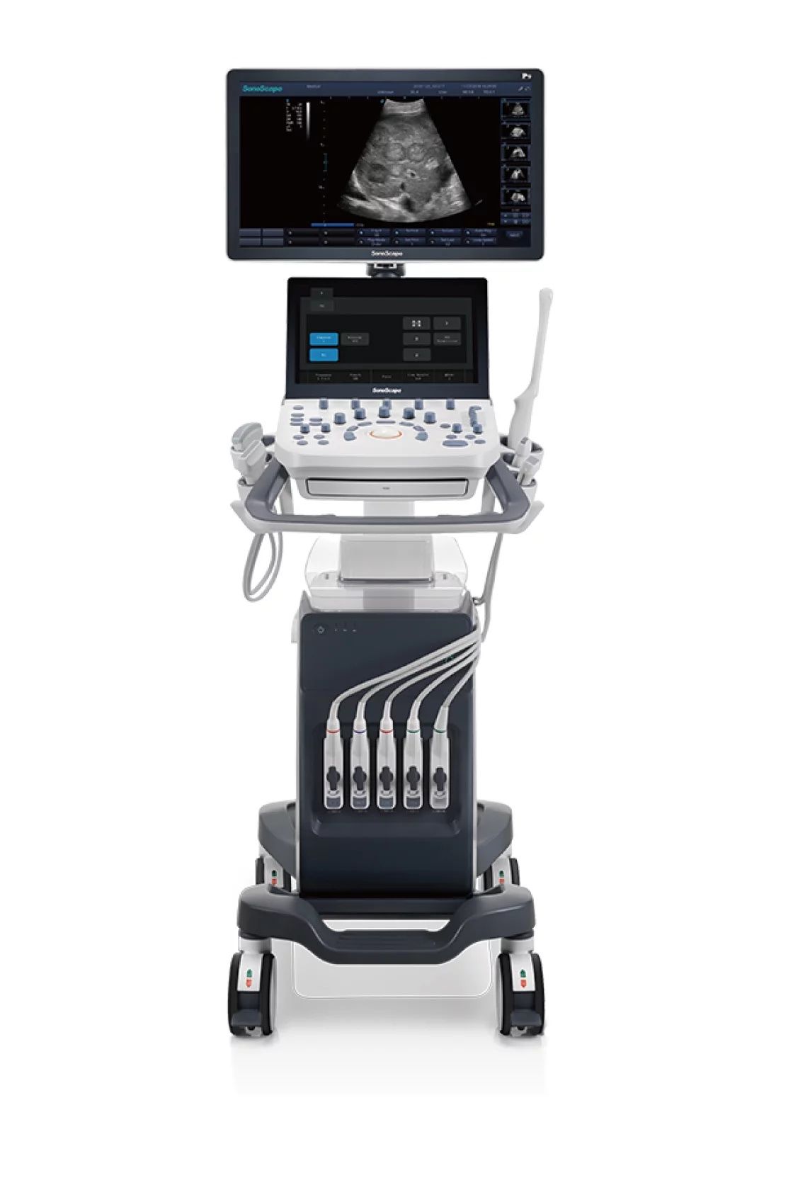 Sonoscope P9 Elite