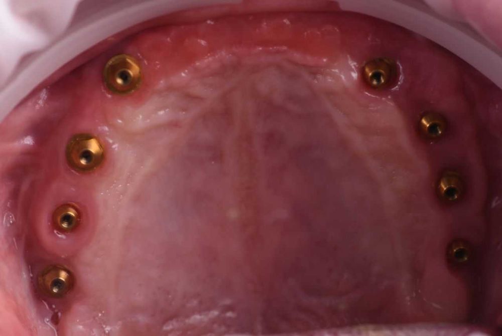 Зуботехническая Технология CAD/CAM в стоматологии