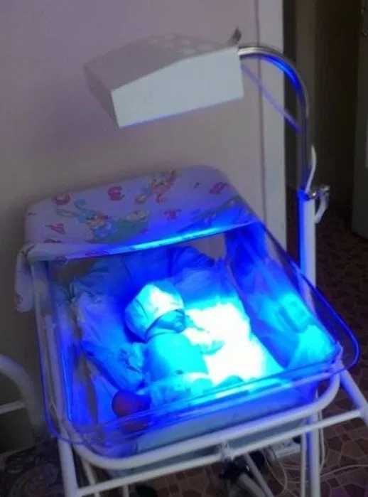 Fotolampa / Fototerapiya / Bilirubin olchash 50000