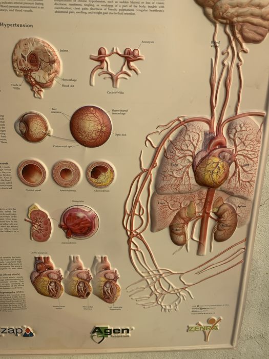 Planse anatomice sistem muscular si hipertensiunea