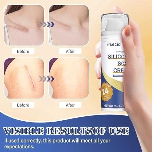 Нов Силиконов крем за белези / хирургия акне стрии изгаряния операции