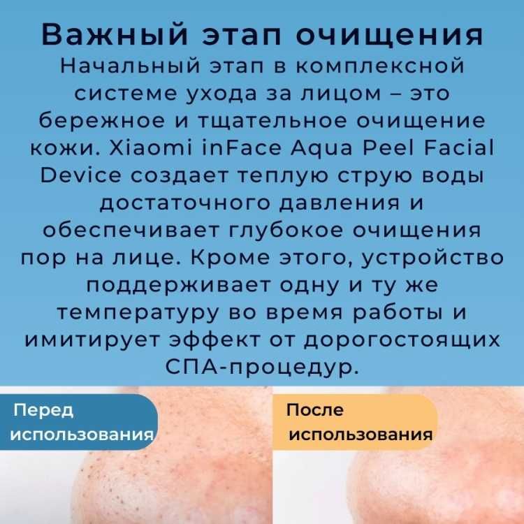 Xiaomi аппарат для аквапилинга