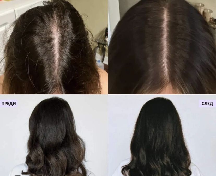 Черен сапун за косопад