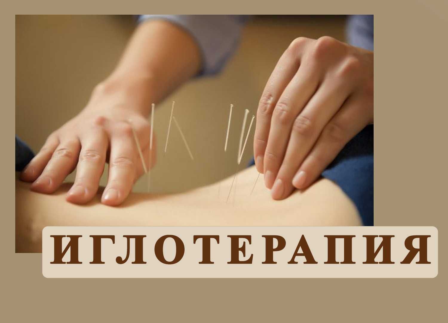 Мануалист Иглоукалывание в Алматы Иглотерапия Манульный Терапевт Q