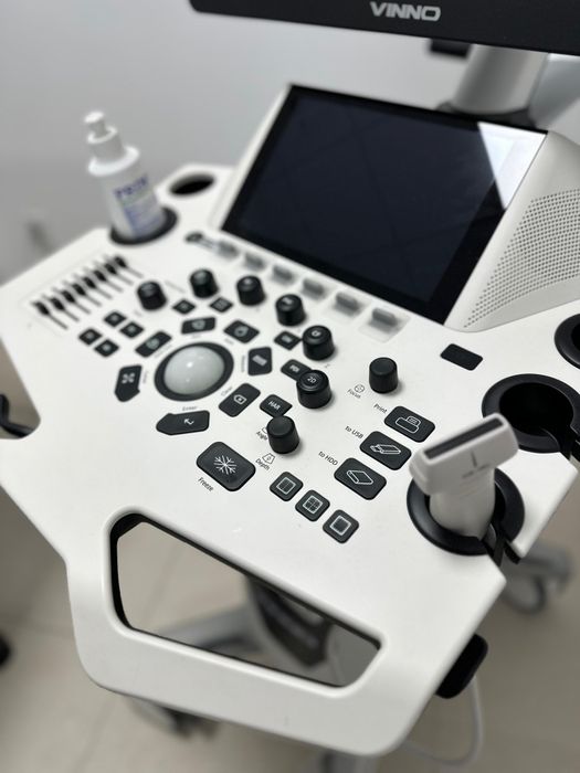 Vând sau închiriez ecograf ViNNO E35 – aproape nou,garanție valabilă
