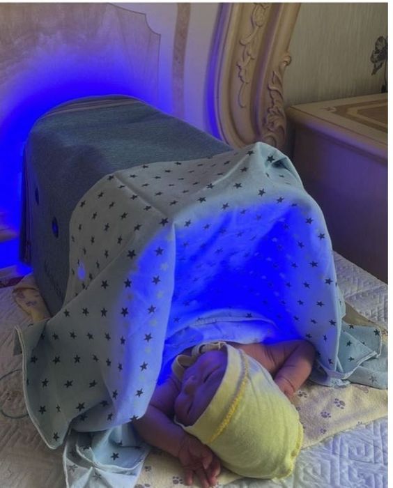 Лампа от белирубина