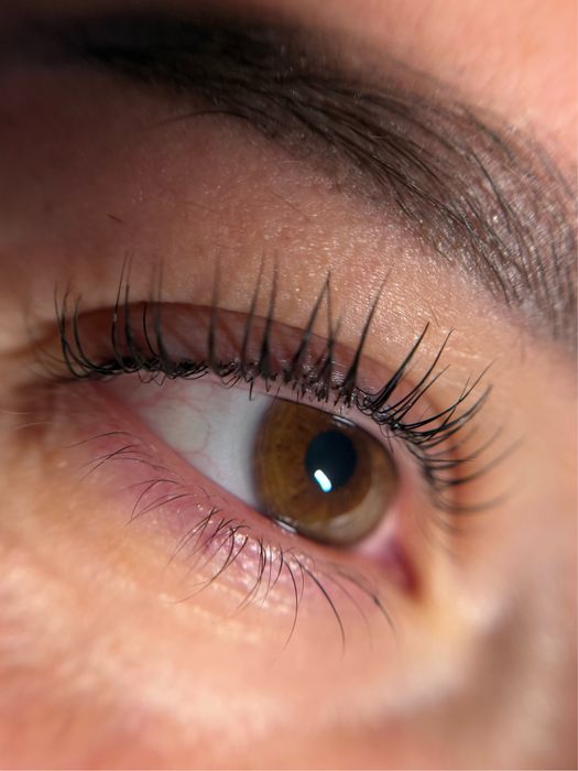 Промоция! Миглопластика и ламиниране