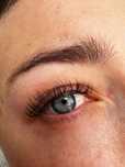Aplicare Extensii Gene