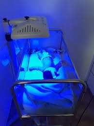 Fotolampa uy sharoitida bilirubin miqdorini olchash 50000