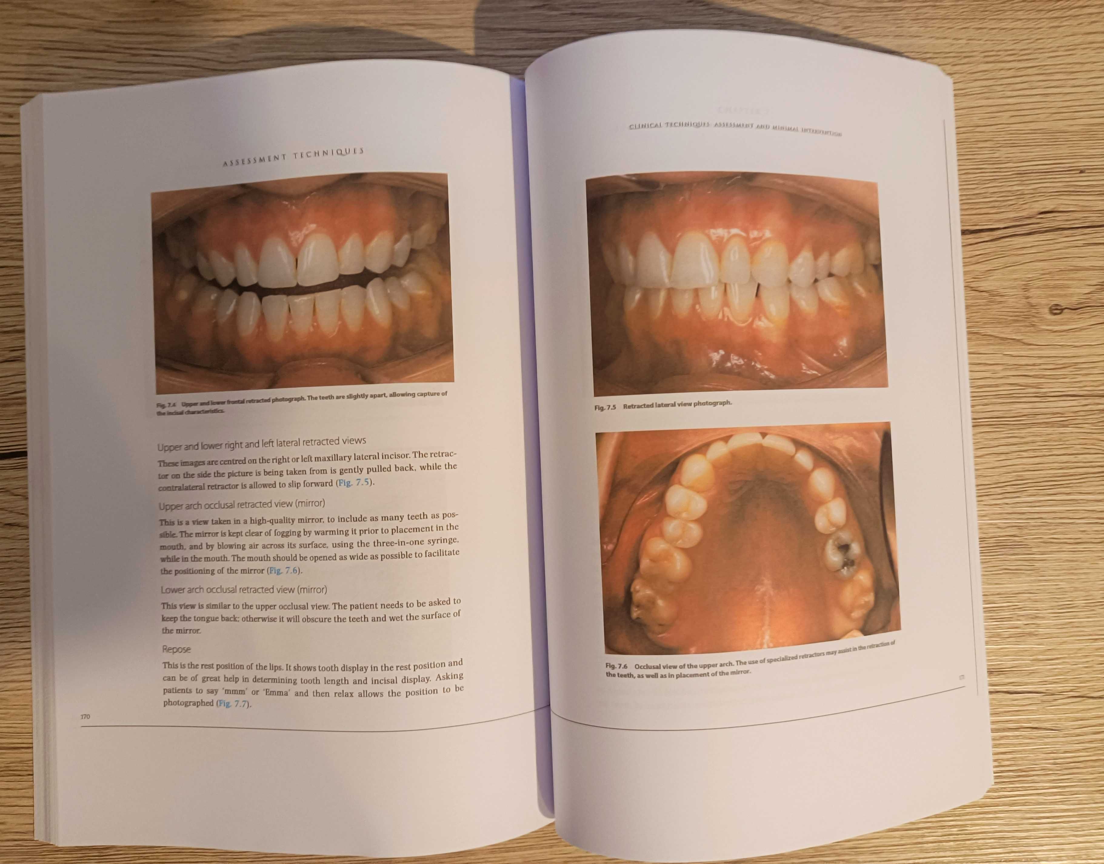 Essentials in Esthetic Dentistry - 3 volume