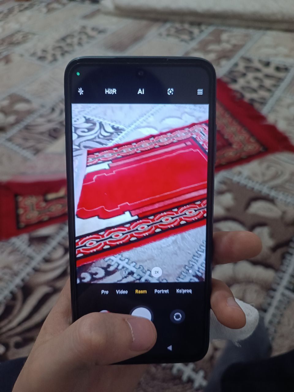 Redmi note 11 aybi yoʻq