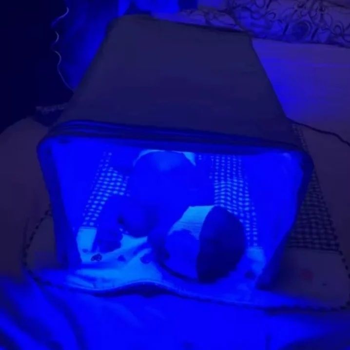 Фотолампа от желтушки для новорожденных