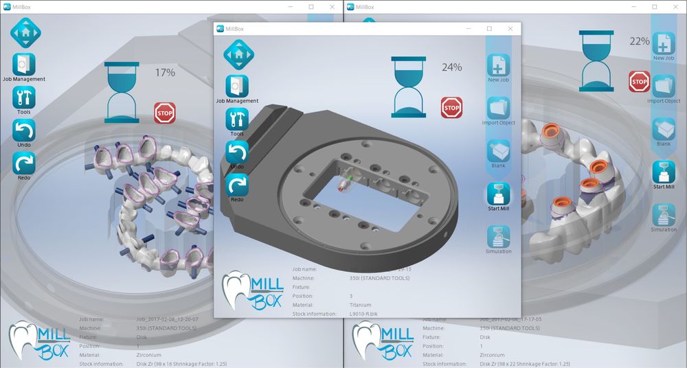 Exocad/ЗShape/Blender For Dental/BlueSkyPlan/Realgude/Invivo/Ezdent